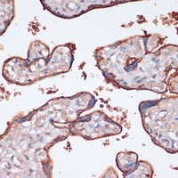 RSK3 Rabbit Polyclonal Antibody