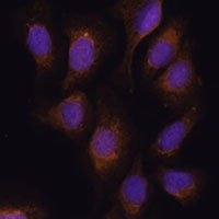 RSK3 Rabbit Polyclonal Antibody