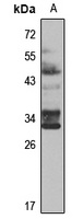RSPO1 Rabbit Polyclonal Antibody