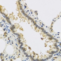 RSPO1 Rabbit Polyclonal Antibody