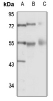 RTCB Rabbit Polyclonal Antibody