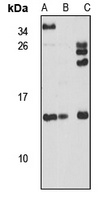 SAA4 Rabbit Polyclonal Antibody