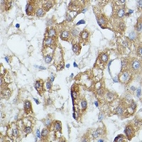 SAA4 Rabbit Polyclonal Antibody