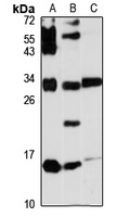 SCGB3A2 Rabbit Polyclonal Antibody