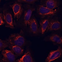 SCGB3A2 Rabbit Polyclonal Antibody