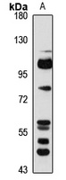 Semaphorin 3F Rabbit Polyclonal Antibody