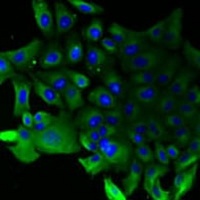 SLA/LP Rabbit Polyclonal Antibody