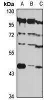 PAI1 Rabbit Polyclonal Antibody