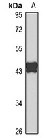 PAI1 Rabbit Polyclonal Antibody
