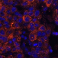 PAI1 Rabbit Polyclonal Antibody