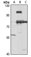 SETDB2 Rabbit Polyclonal Antibody