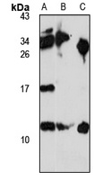 SAP10 Rabbit Polyclonal Antibody