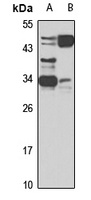 SFRP1 Rabbit Polyclonal Antibody
