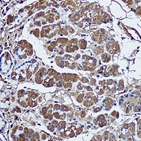 SFRP1 Rabbit Polyclonal Antibody