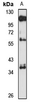 Surfactant Protein D Rabbit Polyclonal Antibody