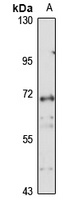 NSP1 Rabbit Polyclonal Antibody