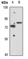 SH3BP2 Rabbit Polyclonal Antibody