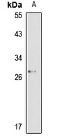 SLA2 Rabbit Polyclonal Antibody