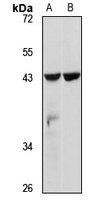 SLC14A1 Rabbit Polyclonal Antibody