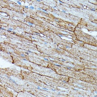 SLC14A1 Rabbit Polyclonal Antibody