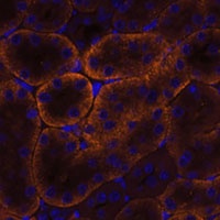 SLC14A1 Rabbit Polyclonal Antibody