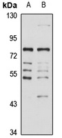 SLC23A1 Rabbit Polyclonal Antibody