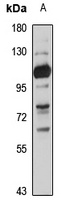 SLC28A3 Rabbit Polyclonal Antibody