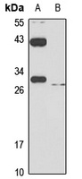 SLC31A1 Rabbit Polyclonal Antibody