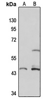 SLC37A4 Rabbit Polyclonal Antibody