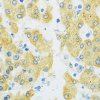 SLC37A4 Rabbit Polyclonal Antibody