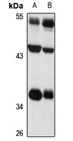SLC7A11 Rabbit Polyclonal Antibody