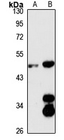 SLC7A9 Rabbit Polyclonal Antibody