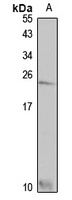 SLURP1 Rabbit Polyclonal Antibody