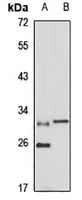EAP30 Rabbit Polyclonal Antibody