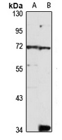 SOCS5 Rabbit Polyclonal Antibody