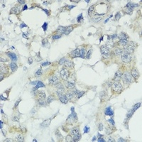 SOCS5 Rabbit Polyclonal Antibody