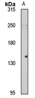 SON Rabbit Polyclonal Antibody