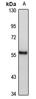 SOX10 Rabbit Polyclonal Antibody