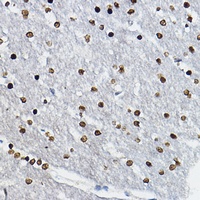 SOX10 Rabbit Polyclonal Antibody