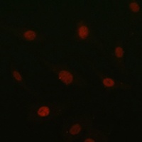 SOX10 Rabbit Polyclonal Antibody