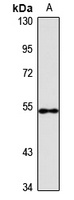 Spastin Rabbit Polyclonal Antibody