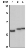 SUCLG2 Rabbit Polyclonal Antibody