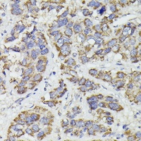 SUCLG2 Rabbit Polyclonal Antibody