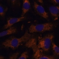 SUCLG2 Rabbit Polyclonal Antibody