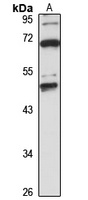 SUMF1 Rabbit Polyclonal Antibody