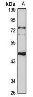 SUV39H1 Rabbit Polyclonal Antibody