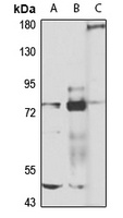 TAB2 Rabbit Polyclonal Antibody