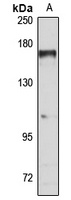 TBC1D1 Rabbit Polyclonal Antibody
