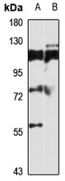 TBC1D15 Rabbit Polyclonal Antibody