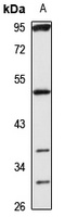 TBX19 Rabbit Polyclonal Antibody